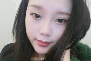河南省人民醫(yī)院雙眼皮成功案例在線分享！