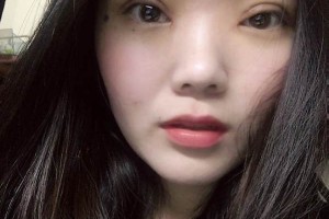 合肥禾麗整形醫(yī)院雙眼皮到底好不好？真實案例測評~