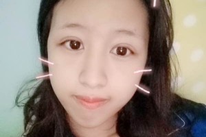 北京愉悅醫(yī)美雙眼皮口碑？醫(yī)院簡介+案例