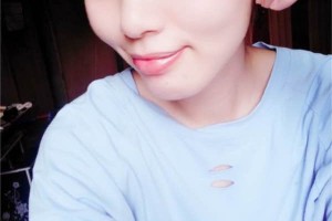 北京協(xié)和整形科｜雙眼皮術(shù)后反饋+費用明細(xì)