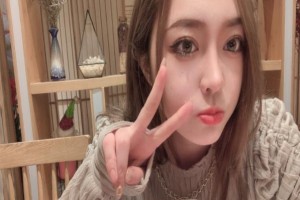 北京藝美醫(yī)療雙眼皮手術(shù)果如何？附2021價格表