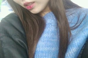 北京117醫(yī)院美容科/鼻部手術(shù)真實果圖!