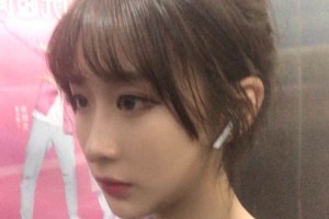 鄭州第一附院整形科靠譜嗎？下頜角真實案例圖