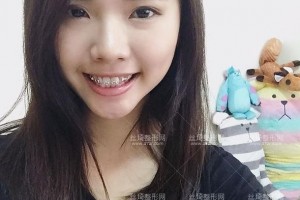 北京拜博口腔醫(yī)院靠譜嗎？附案例圖+價格表