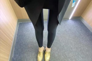 寧波六院整形科溶脂瘦身果如何？附案例圖速看！