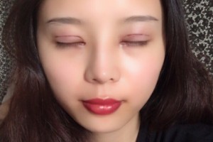 西安星伊美醫(yī)療整形怎么樣？附醫(yī)院簡介+雙眼皮日記