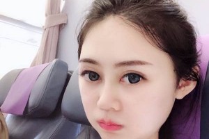 長沙葉子下頜角整形價格表？醫(yī)院介紹+醫(yī)生名單！