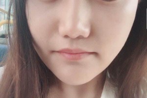 重慶原辰醫(yī)療美容醫(yī)院下頜角怎么樣？醫(yī)生信息介紹