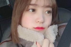 昆明延安醫(yī)院埋線雙眼皮正規(guī)嗎？術后案例實拍分享！