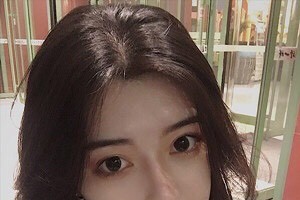 廈門新生毛發(fā)醫(yī)院是正規(guī)嗎？植發(fā)案例+醫(yī)院介紹