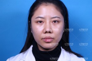 溫州附二醫(yī)激光美容科怎么樣？附案例圖+價格