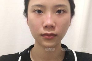 杭州浙一醫(yī)院有做熱瑪吉嗎？附果圖+價格表