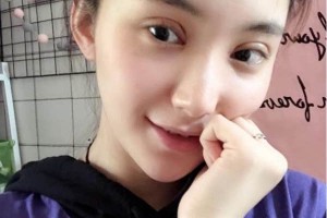 上海千美醫(yī)療美容院定點雙眼皮？術(shù)后術(shù)前明X果～