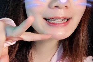 長沙中諾口腔醫(yī)院/牙齒矯正圖片對比！