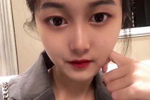 廣州中山三院整形科？下頜角案例介紹+醫(yī)生推薦