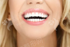 無錫做牙齒美白機構(gòu)排行榜醫(yī)院信息|牙齒美白體驗日記分享!醫(yī)院優(yōu)勢簡介