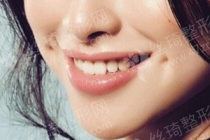 青島做牙齒種植機(jī)構(gòu)排名牙齒種植醫(yī)生術(shù)后體驗(yàn)過(guò)程點(diǎn)評(píng)!醫(yī)院優(yōu)勢(shì)簡(jiǎn)介-醫(yī)院優(yōu)勢(shì)盤(pán)點(diǎn)