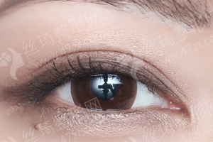 泰安做開(kāi)眼角醫(yī)院排名開(kāi)眼角項(xiàng)目術(shù)后體驗(yàn)記錄點(diǎn)評(píng),醫(yī)院優(yōu)勢(shì)介紹!醫(yī)院優(yōu)勢(shì)盤(pán)點(diǎn)