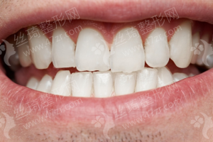 朝陽做隆胸醫(yī)院排行榜醫(yī)院優(yōu)勢-醫(yī)院簡介!醫(yī)院優(yōu)勢