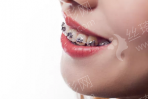 天津做牙齒矯正機(jī)構(gòu)排名醫(yī)院優(yōu)勢(shì)盤(pán)點(diǎn)，醫(yī)院信息，醫(yī)院擅長(zhǎng)