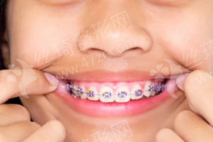 深圳做膠原蛋白除皺醫(yī)生排行榜附最近1年參考價(jià)錢,醫(yī)生簡介!膠原蛋白除皺術(shù)后案例反饋