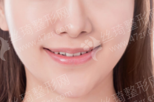 北京做牙齒清潔醫(yī)院排行榜醫(yī)院優(yōu)勢(shì)介紹|牙齒清潔案例記錄分享,牙齒清潔醫(yī)生術(shù)后案例日記評(píng)價(jià)